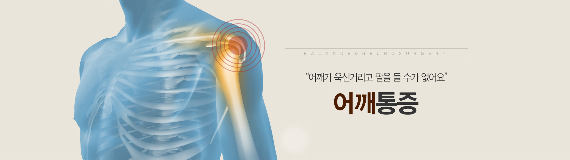 서브 비주얼